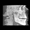 Snaap CBCT | 3D Service