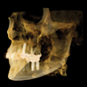 Snaap CBCT | 3D Service