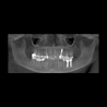 Snaap CBCT | 3D Service