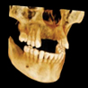 Snaap CBCT | 3D Service