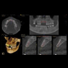 Snaap CBCT | 3D Service