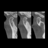 Snaap CBCT | 3D Service