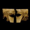 Snaap CBCT | 3D Service