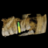 Snaap CBCT | 3D Service