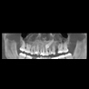 Snaap CBCT | 3D Service