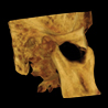 Snaap CBCT | 3D Service