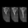 Snaap CBCT | 3D Service