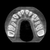 Snaap CBCT | 3D Service